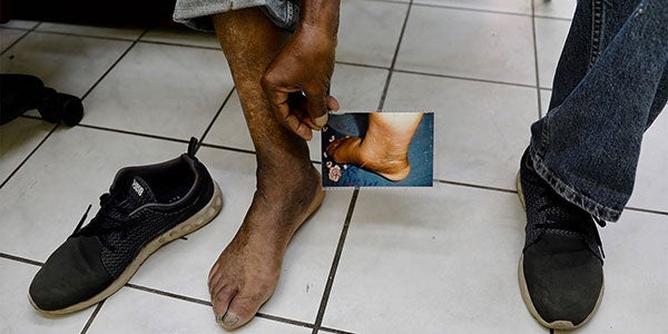 Elimination of the lymphatic filariasis as a public health problem in the Americas