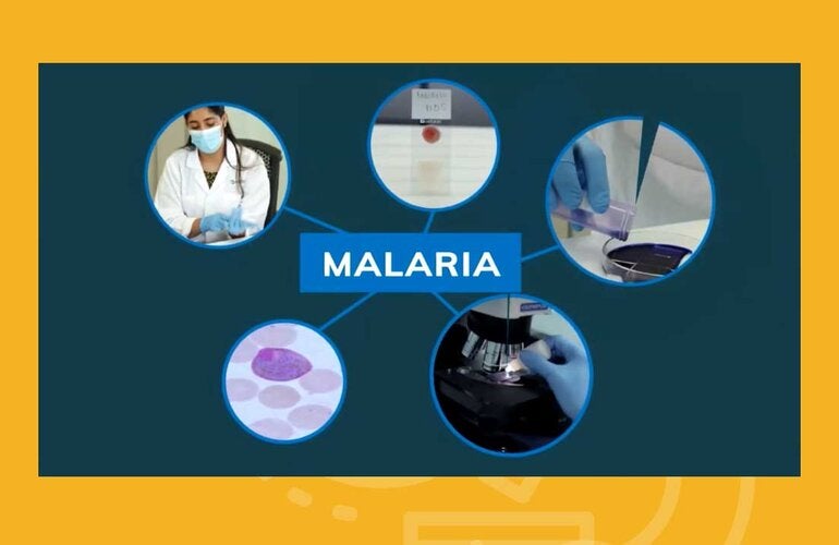 Lanzamiento de curso teórico de autoaprendizaje Diagnóstico Microscópico de la Malaria