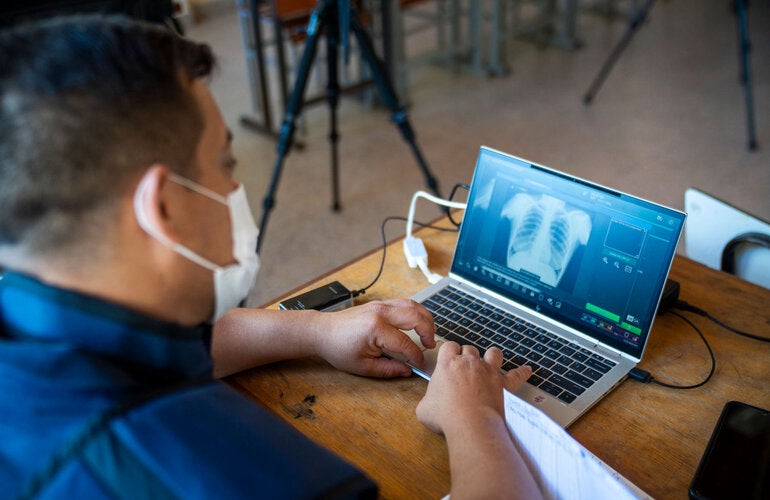 Trabajador de salud utiliza tecnología para identificar la presencia de tuberculosis en el paciente.