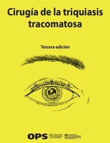 Cirugía de la triquiasis tracomatosa. Tercera edición