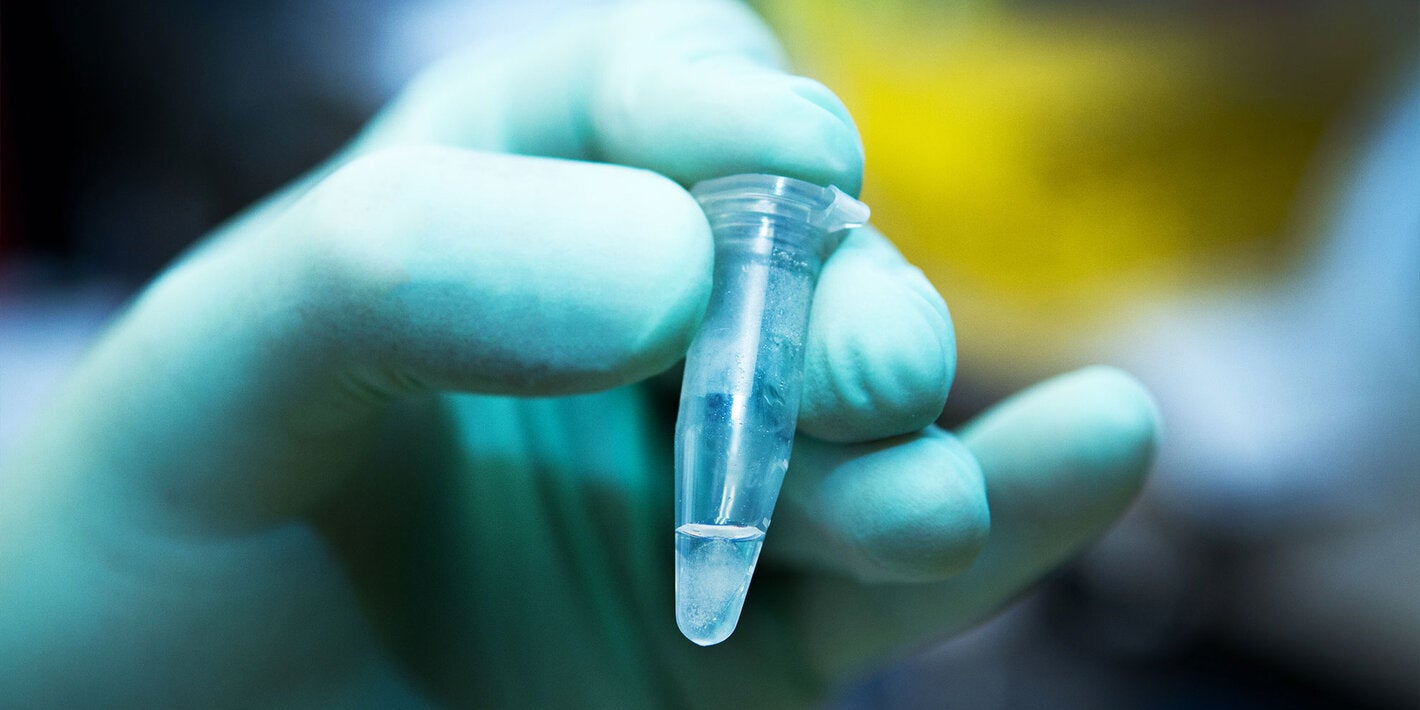 Researcher with green gloves holds laboratory vile