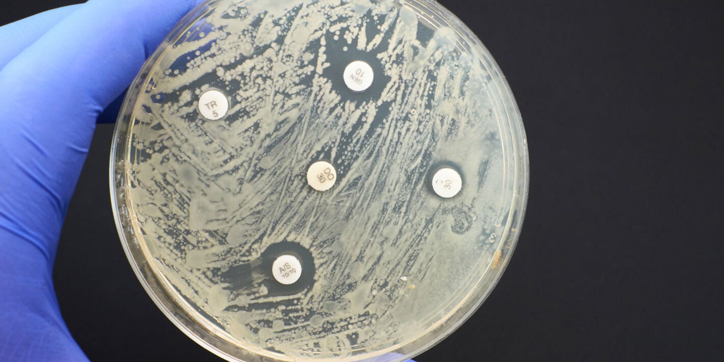 Antimicrobial sensitivity test