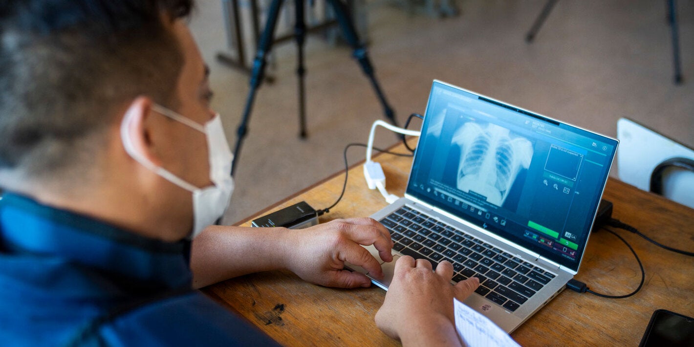 Health worker uses imaging to identify the presence of TB in patient.