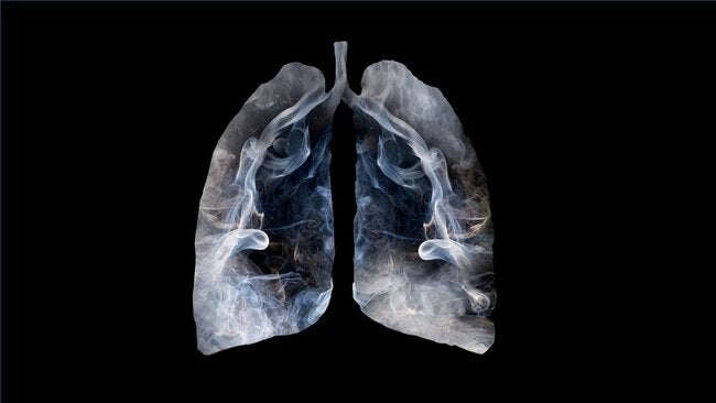 El vapor del cigarrillo electrónico aumenta la inflamación del pulmón