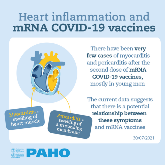 Covid vaccine myocarditis Myocarditis: A
