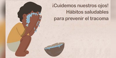 ¡Cuidemos nuestros ojos! Hábitos saludables para prevenir el tracoma